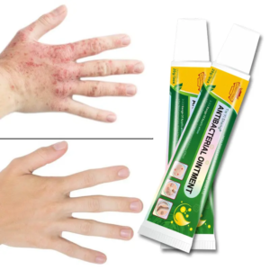 ANTYBACTERIAL OINTMENT 1ps